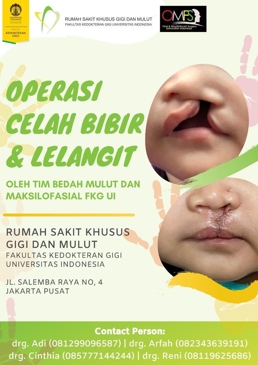 Departemen Bedah Mulut dan Maksilofasial FKG UI Gelar Operasi Celah Bibir Perdana