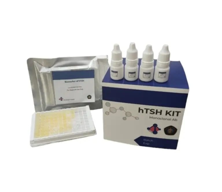 hTSH KIT, Deteksi Hipotorid Sejak Bayi Baru Lahir Karya Dosen UB