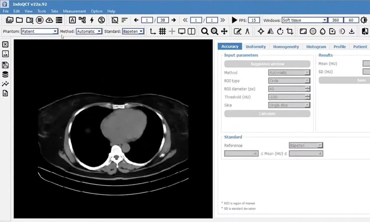 Riset UNDIP Hadirkan Inovasi CT Scan yang Diakses Lebih dari 90 Negara